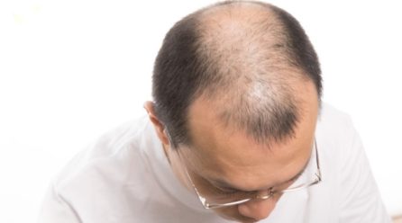育毛初心者はまずチェック！男性の育毛で注意すること