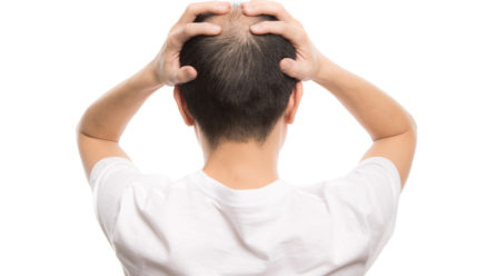 抜け毛に気付いたらすぐにでもヘアケアを始めよう