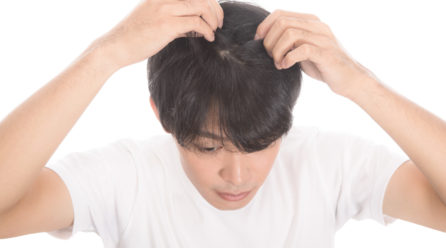 頭皮が臭い？！気になる頭皮のにおいケア