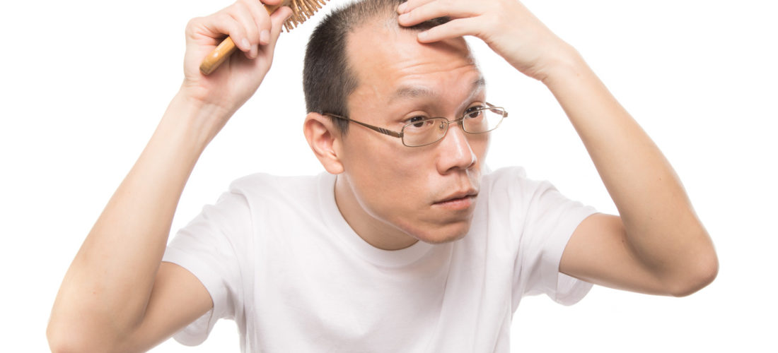お風呂上がりの頭皮ケアは薄毛で悩んでいるメンズは必須！
