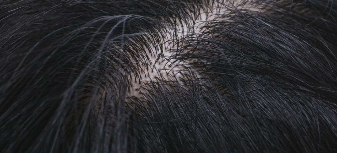 ヘアケアと頭皮ケアはどちらが大切？目的別に徹底解説