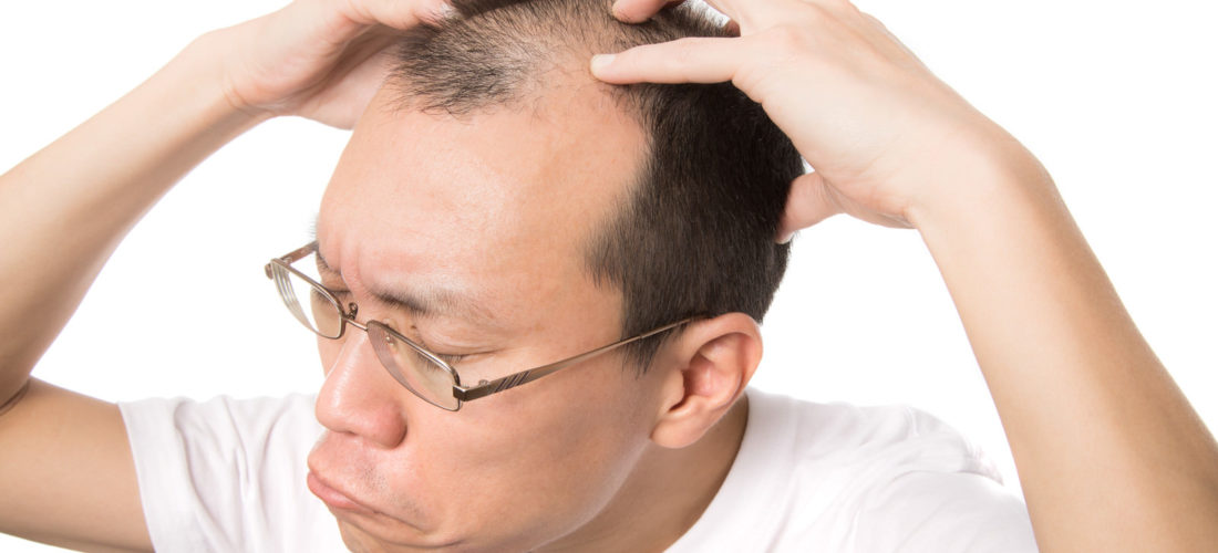 シャワーで抜け毛が大量発生！AGA？どんな対策をすべき？