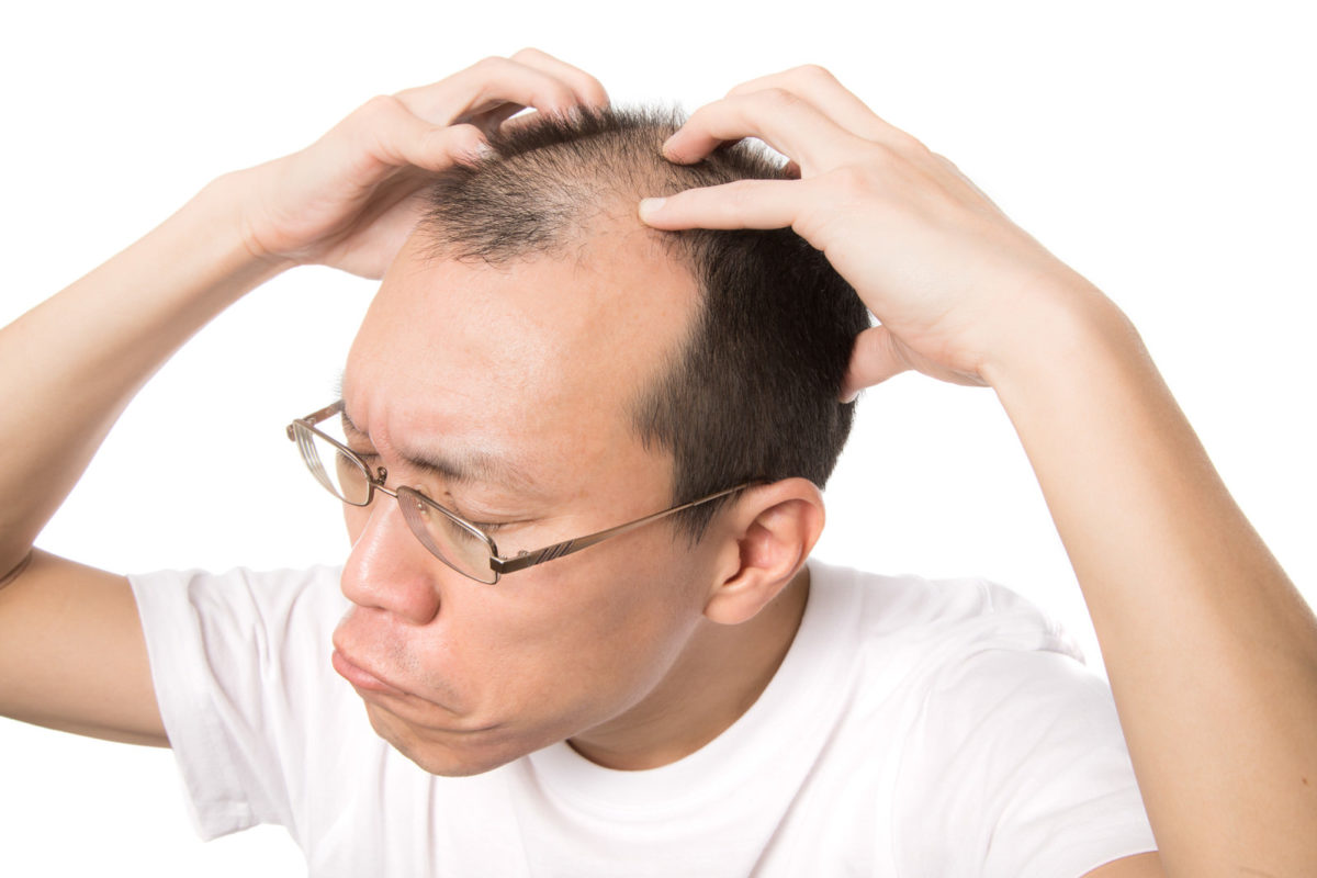 シャワーで抜け毛が大量発生！AGA？どんな対策をすべき？