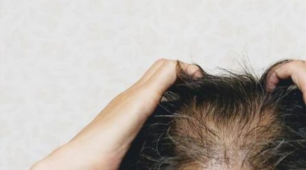 禁煙による髪への効果｜生えたという話は本当？