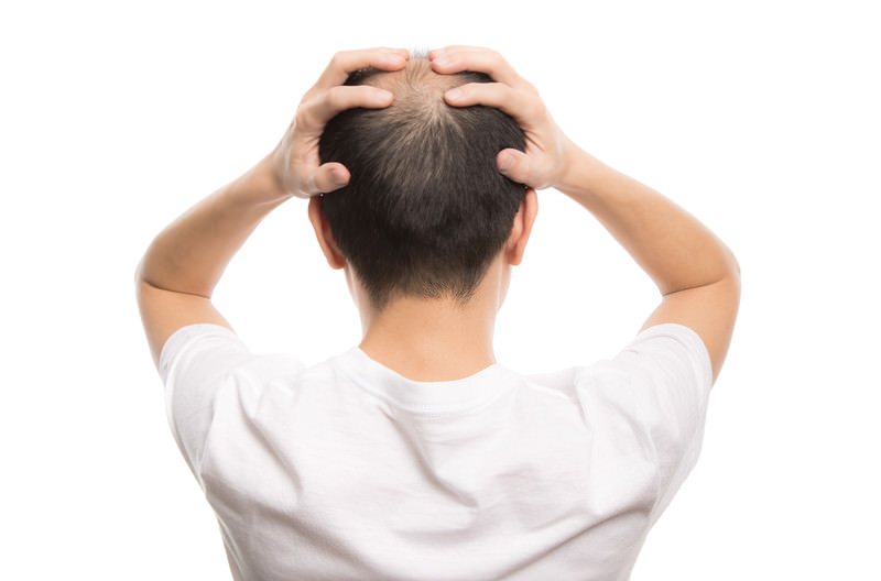 若はげの予防方法とは？原因から対策まで徹底解説