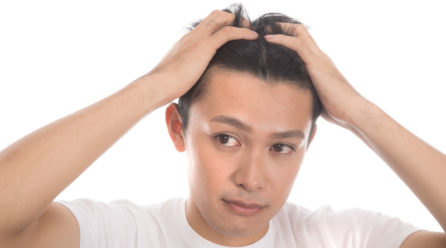 急に剥げてきたと自覚した時にすることと控えるべき行動は？