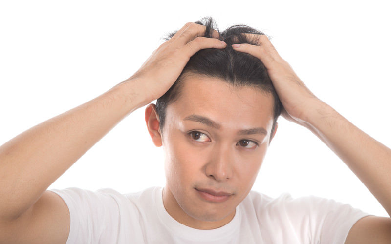 急に剥げてきたと自覚した時にすることと控えるべき行動は？