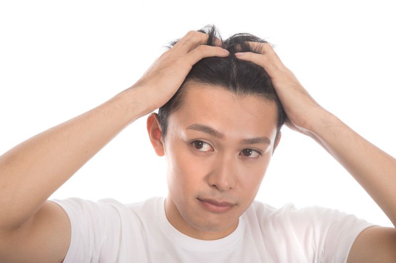 急に剥げてきたと自覚した時にすることと控えるべき行動は？