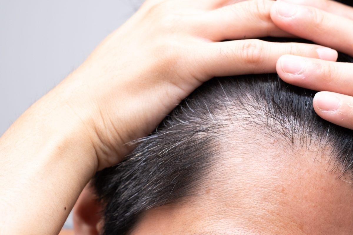 髪が柔らかい男はハゲやすいって本当？噂を化学的見地から徹底検証